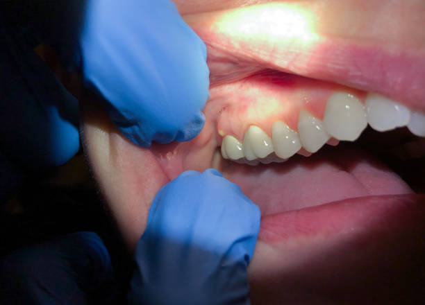 Urgent Tooth Repair in IL