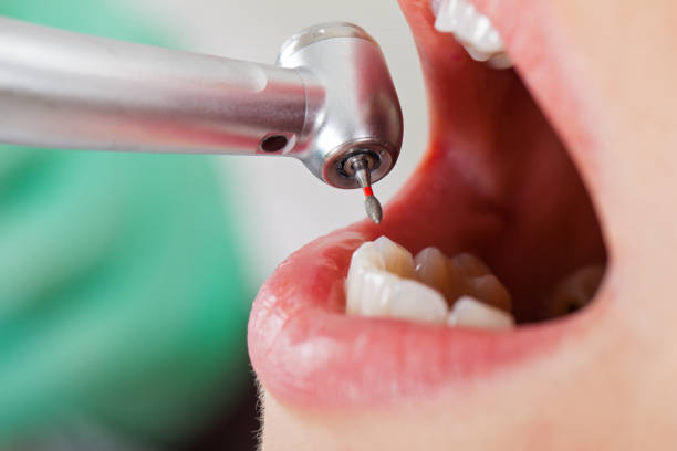Best Tooth Infection Emergency Dentist  in South Pekin, IL
